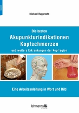 Die besten Akupunkturindikationen Kopfschmerzen und weitere Erkrankungen der Kopfregion - Michael Rupprecht