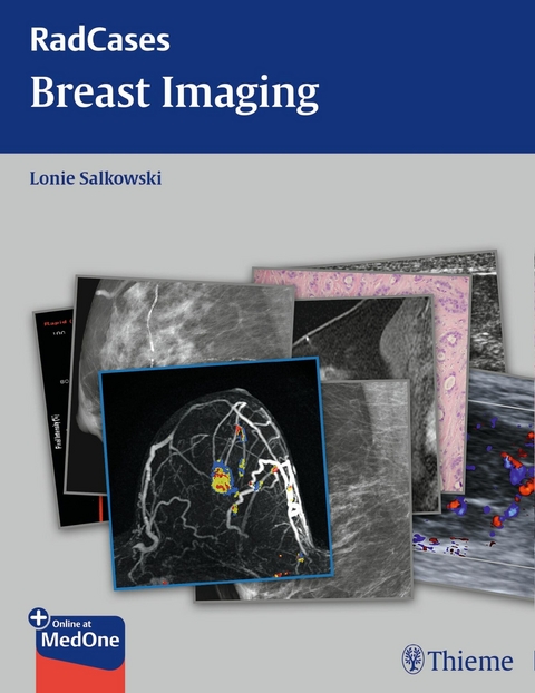 Radcases Breast Imaging -  Lonie L. Salkowski