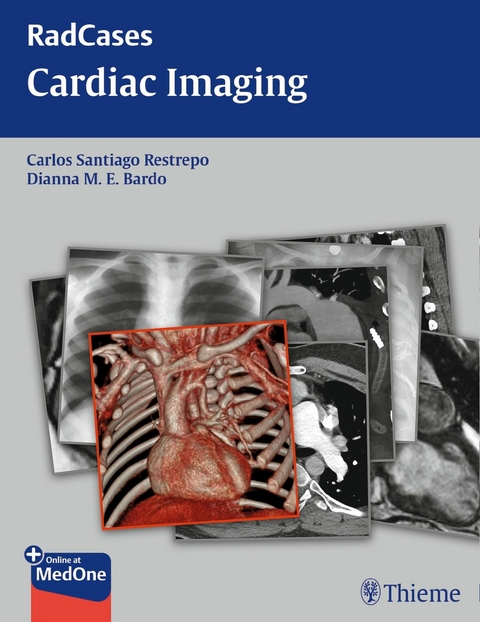 Radcases Cardiac Imaging - Carlos S Restrepo, Dianna M. E. Bardo