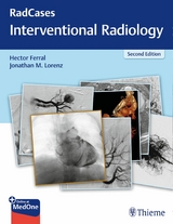 RadCases Q&A Interventional Radiology -  Hector Ferral,  Jonathan M. Lorenz