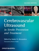 Cerebrovascular Ultrasound in Stroke Prevention and Treatment - Alexandrov, Andrei V.