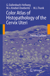 Color Atlas of Histopathology of the Cervix Uteri - Dallenbach-Hellweg, Gisela; Knebel Doeberitz, Magnus; Trunk, Marcus J.