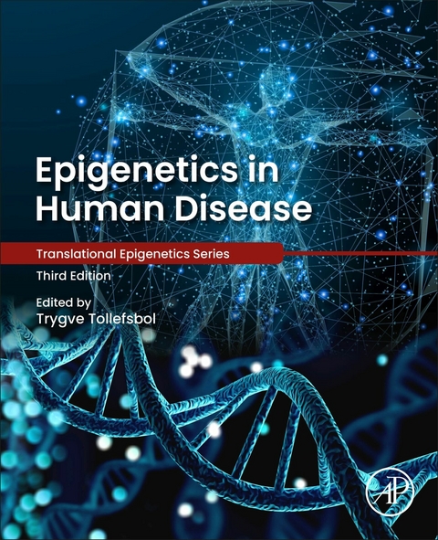 Epigenetics in Human Disease - 