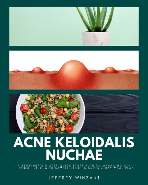 Acne Keloidalis Nuchae -  Jeffrey Winzant