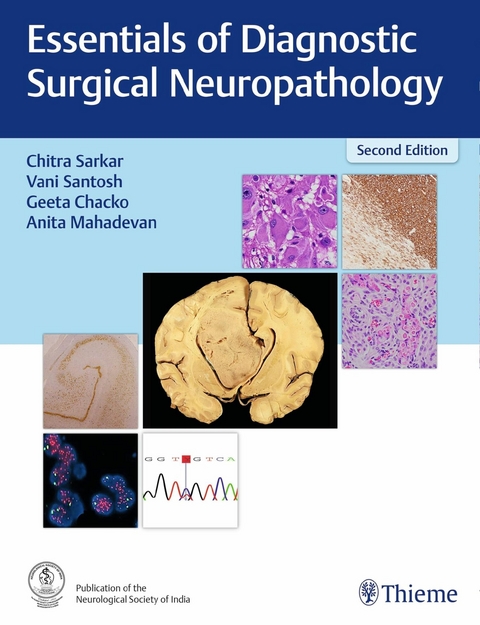 Essentials of Diagnostic Surgical Neuropathology - 