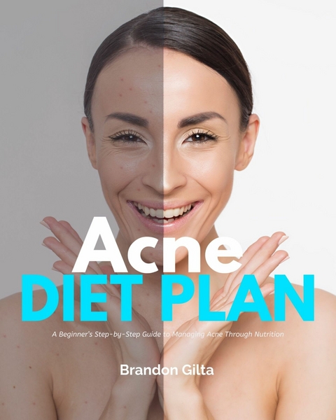 Acne Diet Plan -  Brandon Gilta