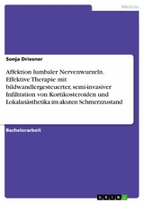 Affektion lumbaler Nervenwurzeln. Effektive Therapie mit bildwandlergesteuerter, semi-invasiver Infiltration von Kortikosteroiden und Lokalanästhetika im akuten Schmerzzustand -  Sonja Driesner