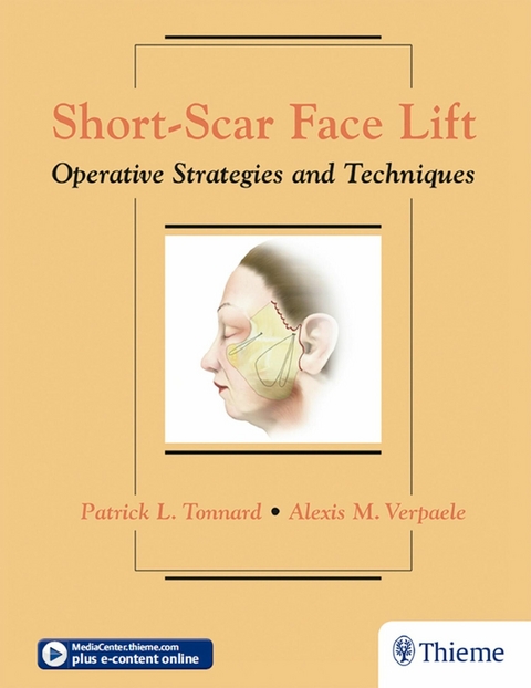 Short-Scar Face Lift - Patrick Tonnard, Alexis Verpaele