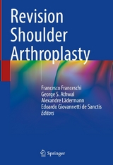 Revision Shoulder Arthroplasty - 