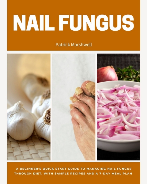 Nail Fungus -  Patrick Marshwell