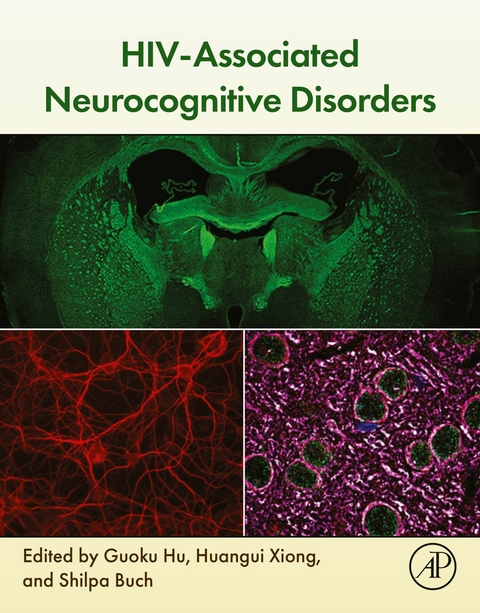 HIV-Associated Neurocognitive Disorders - 