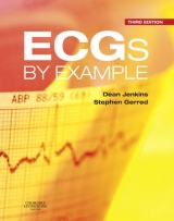 ECGs by Example - Jenkins, Dean; Gerred, Stephen John