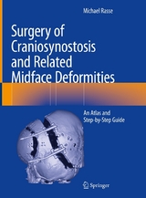 Surgery of Craniosynostosis and Related Midface Deformities -  Michael Rasse