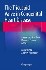 The Tricuspid Valve in Congenital Heart Disease - 