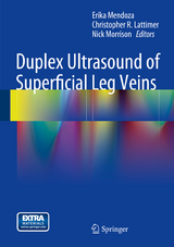 Duplex Ultrasound of Superficial Leg Veins - 