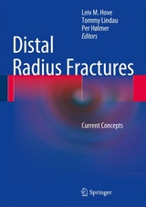 Distal Radius Fractures - 