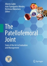 The Patellofemoral Joint - 