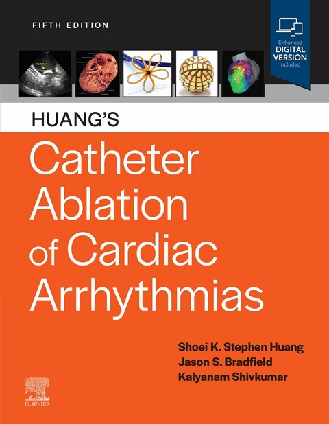 Catheter Ablation of Cardiac Arrhythmias - 