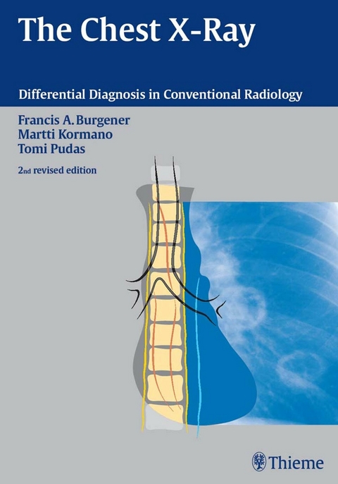 The Chest X-Ray - Francis A. Burgener, Martti Kormano, Tomi Pudas