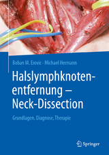 Halslymphknotenentfernung – Neck-Dissection - Boban M. Erovic, Michael Hermann