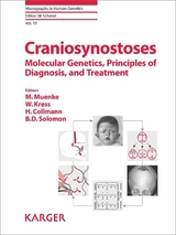 Craniosynostoses - 