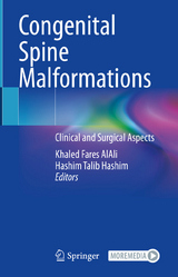 Congenital Spine Malformations - 