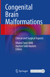 Congenital Brain Malformations - 