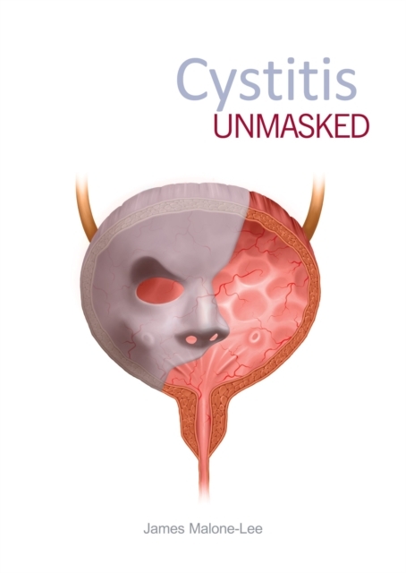 Cystitis unmasked -  James Malone-Lee