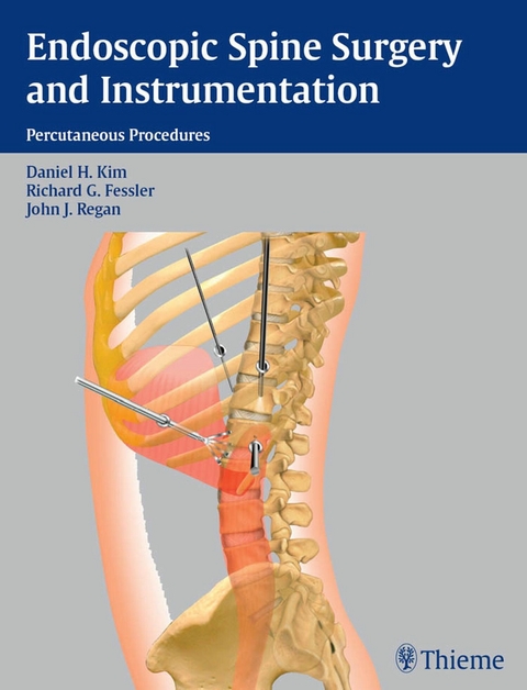 Endoscopic Spine Surgery and Instrumentation - 