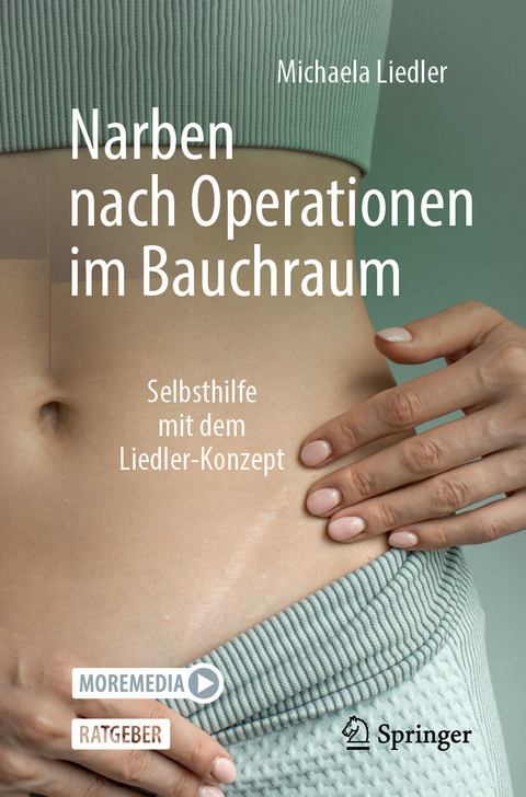 Narben nach Operationen im Bauchraum -  Michaela Liedler