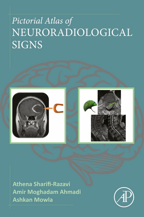 Pictorial Atlas of Neuroradiological Signs -  Amir Moghadam Ahmadi,  Ashkan Mowla,  Athena Sharifi-Razavi