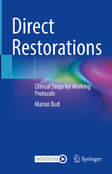 Direct Restorations - Marius Bud