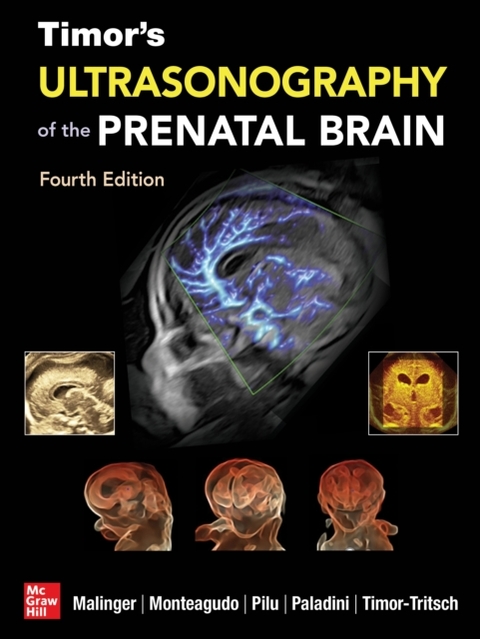 Timor's Ultrasonography of the Prenatal Brain, Fourth Edition -  Gustavo Malinger,  Ana Monteagudo,  Gianluigi Pilu,  Ilan Timor-Tritsch