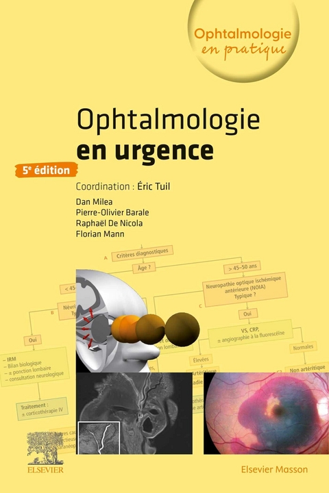 Ophtalmologie en urgence -  Pierre-Olivier Barale,  Florian Mann,  Dan Milea,  Raphael de Nicola,  Eric Tuil