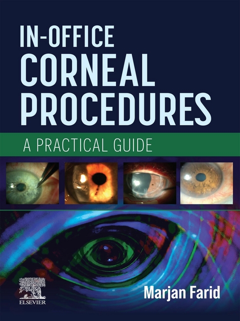 In-Office Corneal Procedures - 