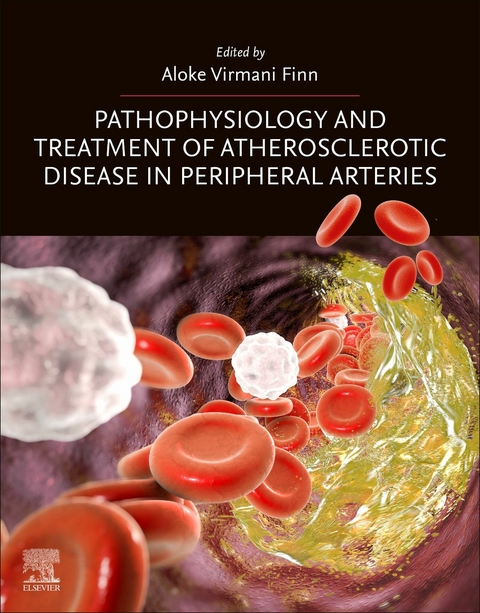 Pathophysiology and Treatment of Atherosclerotic Disease in Peripheral Arteries - 