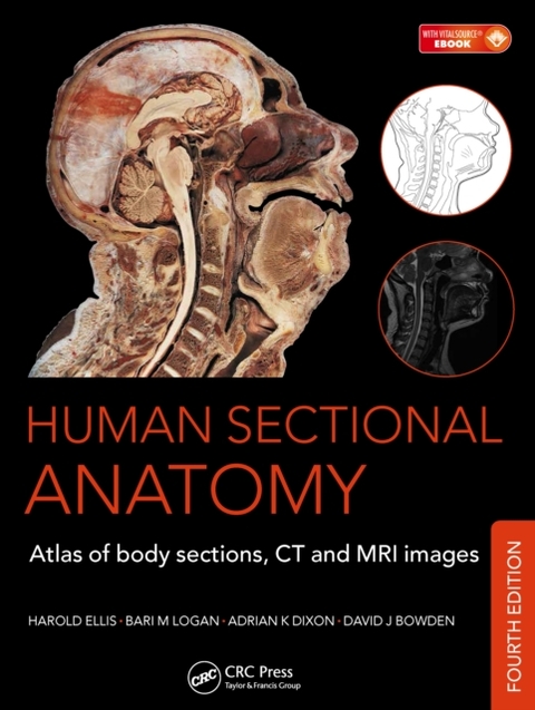 Human Sectional Anatomy -  David J. Bowden,  Adrian K. Dixon,  Harold Ellis,  Bari M. Logan