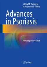 Advances in Psoriasis - 