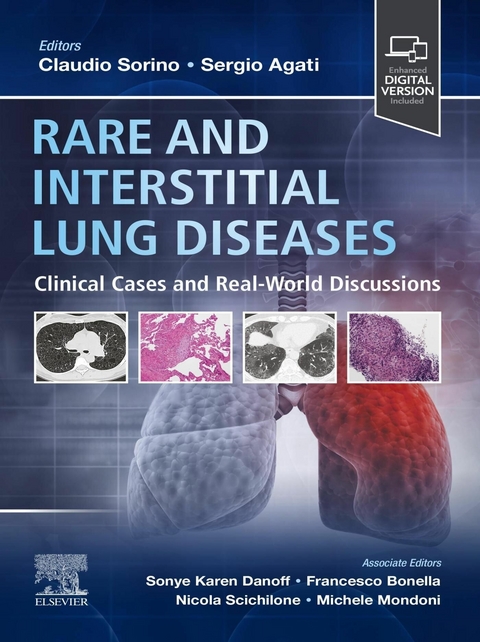 Rare and Interstitial Lung Diseases - E-Book - 