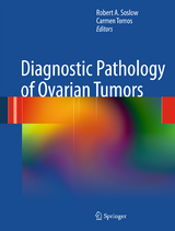 Diagnostic Pathology of Ovarian Tumors - 