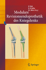 Revisionsendoprothetik des Kniegelenks - 