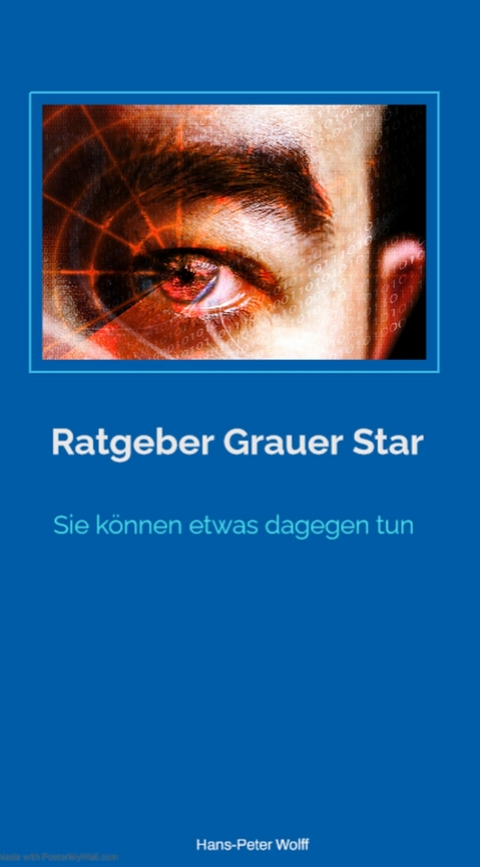 Ratgeber grauer Star - Hans-Peter Wolff