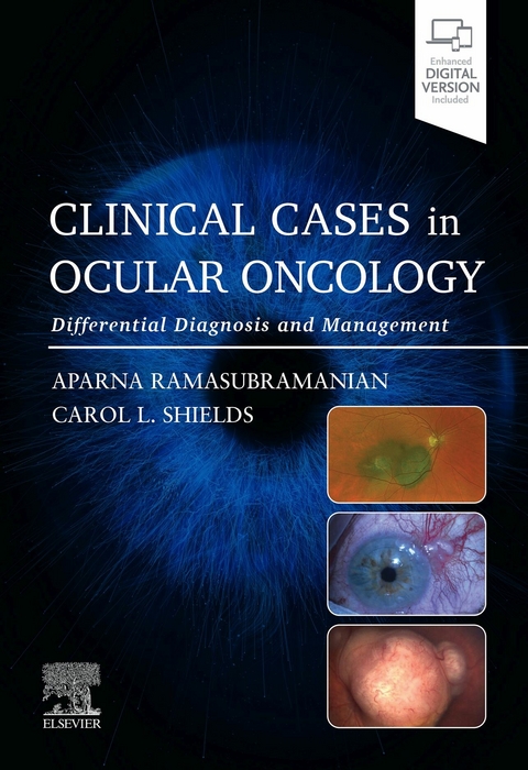 Clinical Cases in Ocular Oncology - 