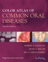 Color Atlas of Common Oral Diseases - Langlais, Robert P.; Miller, Craig S.; Nield-Gehrig, Jill S.