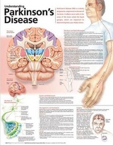 Understanding Parkinson's Disease Anatomical Chart - 