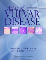 Atlas of Vulvar Disease - Wilkinson, Edward J.; Stone, I. Keith