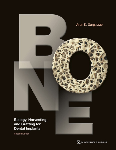 Bone - Arun K. Garg