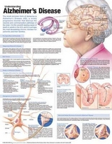 Understanding Alzheimer's Disease Anatomical Chart - 