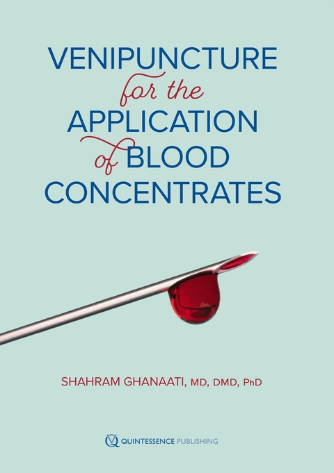 Venipuncture for the Application of Blood Concentrates - Shahram Ghanaati