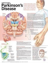 Understanding Parkinson's Disease Anatomical Chart - 